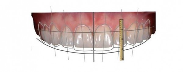 3d Model of Teeth