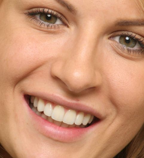 Claire's Story - Cosmetic Dentistry