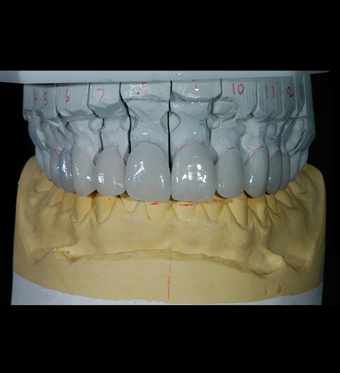 Claire's Story - Cosmetic Dentistry