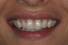 Claire's Story - Cosmetic Dentistry