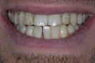 David's Story - Cosmetic Dentistry