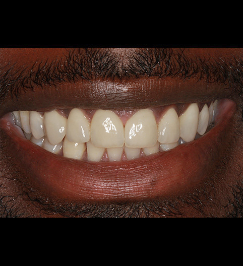 Garnier's Story - Cosmetic Dentistry