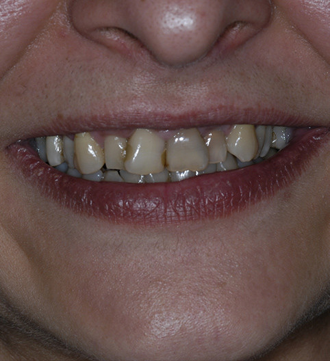 Lenka's Story - Cosmetic Dentistry