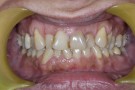 Lenka's Story - Cosmetic Dentistry