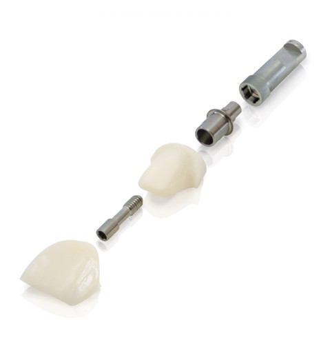 At Luke Barnett we work with a number of the leading implant systems including Nobel Procera, Straumann , Ankylos, Astra, Southern, Bio Horizons plus most key brands.