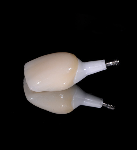 Sarah's Story - Implant Restorative