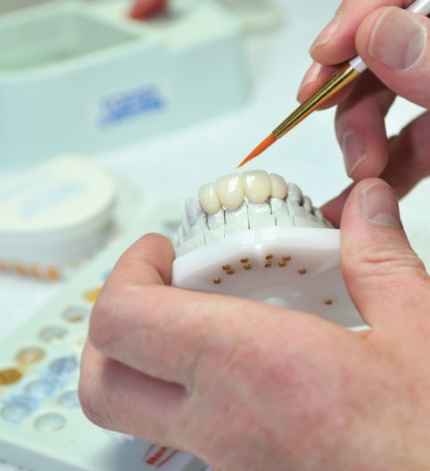 Luke Barnett Centre - Whitening Tray Production